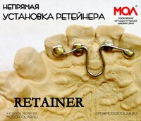 Непрямая установка РЕТЕЙНЕРА
